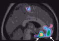 Brain Workshop Training